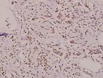 SH2D2A Antibody in Immunohistochemistry (Paraffin) (IHC (P))