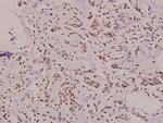 SH2D2A Polyclonal Antibody