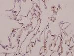 TAUT Polyclonal Antibody