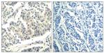 Phospho-ABL1/ABL2 (Tyr393, Tyr439) Antibody in Immunohistochemistry (Paraffin) (IHC (P))