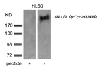 Phospho-ABL1/ABL2 (Tyr393, Tyr439) Antibody in Western Blot (WB)