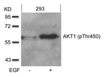 Phospho-AKT1 (Thr450) Antibody in Western Blot (WB)