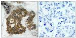 Phospho-AKT2 (Ser474) Polyclonal Antibody