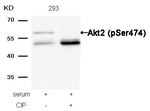 Phospho-AKT2 (Ser474) Antibody in Western Blot (WB)