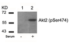 Phospho-AKT2 (Ser474) Antibody in Western Blot (WB)