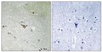 Phospho-ALK (Tyr1096) Antibody in Immunohistochemistry (Paraffin) (IHC (P))