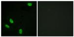 Phospho-Progesterone Receptor (Ser294) Polyclonal Antibody