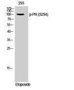 Phospho-Progesterone Receptor (Ser294) Antibody in Western Blot (WB)