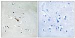 Phospho-APLP2 (Tyr755) Polyclonal Antibody