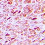 Phospho-Androgen Receptor (Ser213) Antibody in Immunohistochemistry (Paraffin) (IHC (P))