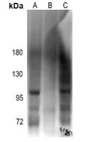 Phospho-Androgen Receptor (Ser213) Antibody in Western Blot (WB)