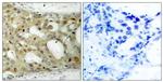 Phospho-Androgen Receptor (Ser650) Polyclonal Antibody