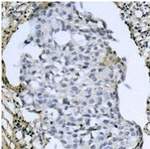 Phospho-ATF4 (Ser245) Antibody in Immunohistochemistry (Paraffin) (IHC (P))