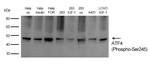 Phospho-ATF4 (Ser245) Antibody in Western Blot (WB)