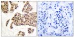 Phospho-BAD (Ser91, Ser128) Polyclonal Antibody