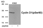 Phospho-Cyclin D1 (Ser90) Antibody in Western Blot (WB)