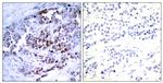 Phospho-Bcl-2 (Ser70) Antibody in Immunohistochemistry (Paraffin) (IHC (P))
