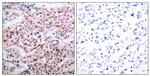 Phospho-Bcl-2 (Thr56) Antibody in Immunohistochemistry (Paraffin) (IHC (P))