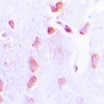 Phospho-Bcl-2 (Thr69) Antibody in Immunohistochemistry (Paraffin) (IHC (P))