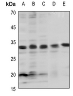 Phospho-Bcl-2 (Thr69) Antibody in Western Blot (WB)