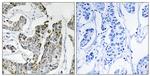 Phospho-BLK (Tyr501) Polyclonal Antibody