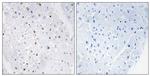 Phospho-Blooms Syndrome (Thr99) Polyclonal Antibody