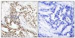 Phospho-BRCA1 (Ser1423) Antibody in Immunohistochemistry (Paraffin) (IHC (P))