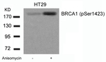 Phospho-BRCA1 (Ser1423) Antibody in Western Blot (WB)