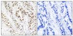 Phospho-BRCA1 (Ser1524) Polyclonal Antibody