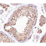 Phospho-B-Raf (Thr599) Antibody in Immunohistochemistry (Paraffin) (IHC (P))