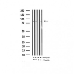 Phospho-B-Raf (Thr599) Antibody in Western Blot (WB)