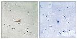 Phospho-MCK10 (Tyr513) Antibody in Immunohistochemistry (Paraffin) (IHC (P))