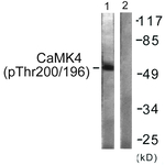 Phospho-CaMKIV (Thr196, Thr200) Antibody in Western Blot (WB)