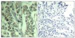 Phospho-c-Cbl (Tyr700) Antibody in Immunohistochemistry (Paraffin) (IHC (P))