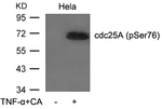 Phospho-Cdc25A (Ser76) Antibody in Western Blot (WB)