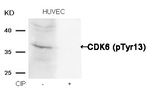 Phospho-CDK6 (Tyr13) Antibody in Western Blot (WB)