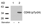 Phospho-CDK6 (Tyr24) Antibody in Western Blot (WB)