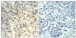 Phospho-Cofilin (Tyr139) Polyclonal Antibody