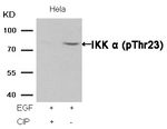 Phospho-IKK alpha (Thr23) Antibody in Western Blot (WB)