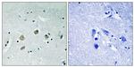 Phospho-TPL2 (Ser400) Polyclonal Antibody