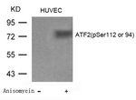 Phospho-ATF2 (Ser94, Ser112) Antibody in Western Blot (WB)