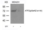 Phospho-ATF2 (Ser44, Ser62) Antibody in Western Blot (WB)