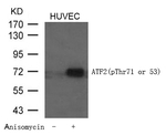Phospho-ATF2 (Thr53, Thr71) Antibody in Western Blot (WB)