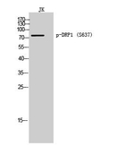 Phospho-DRP1 (Ser637) Antibody in Western Blot (WB)
