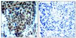 Phospho-p38 MAPK (Thr180) Polyclonal Antibody