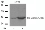 Phospho-p38 MAPK (Thr180) Antibody in Western Blot (WB)