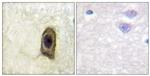 Phospho-CSF1R (Tyr561) Polyclonal Antibody