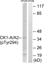 Phospho-CK1 alpha (Tyr294) Antibody in Western Blot (WB)