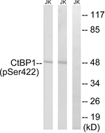 Phospho-CtBP1 (Ser422) Antibody in Western Blot (WB)
