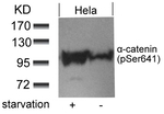 Phospho-alpha Catenin (Ser641) Antibody in Western Blot (WB)